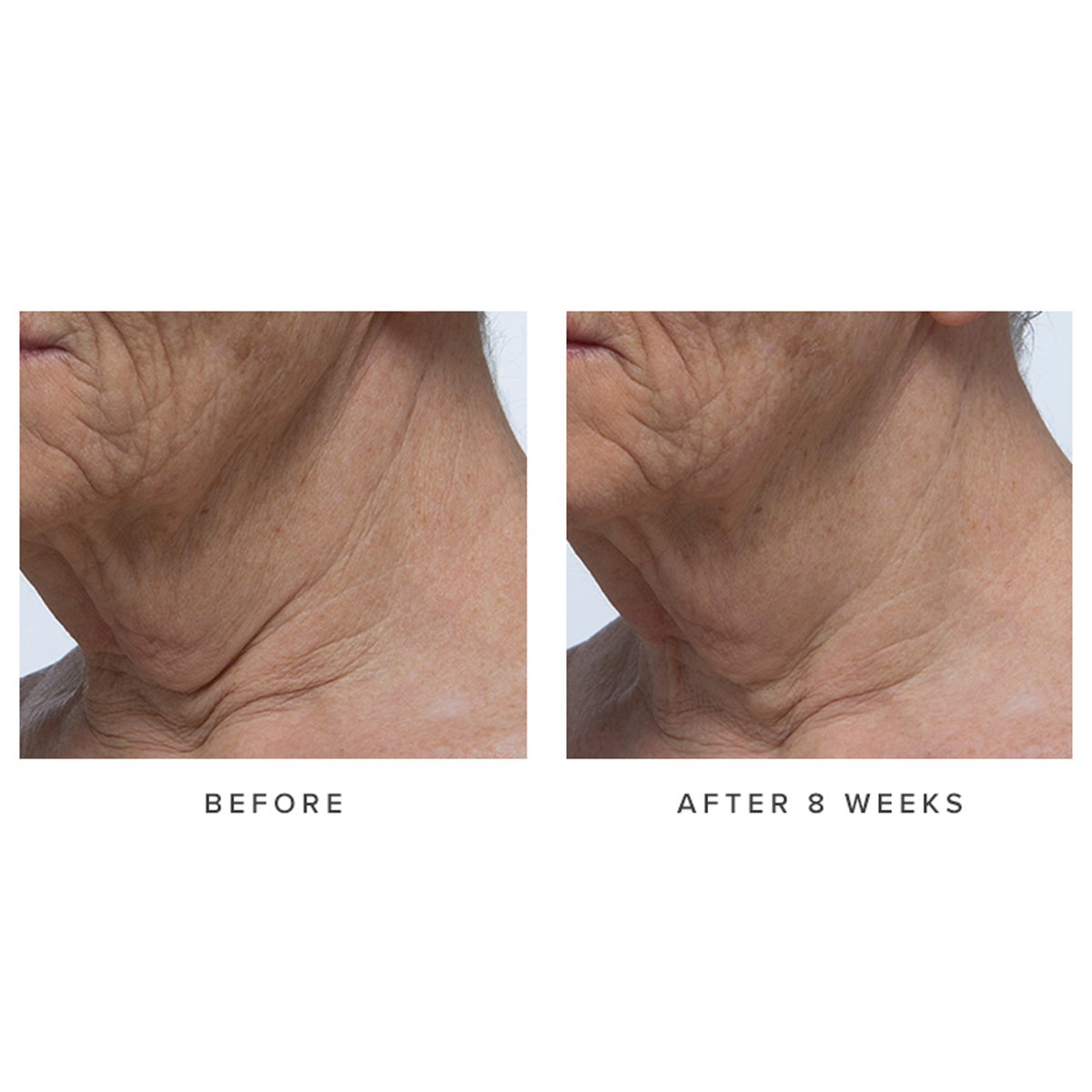 Ageless Revitalizing Neck Cream - Everyday Beauty Essential