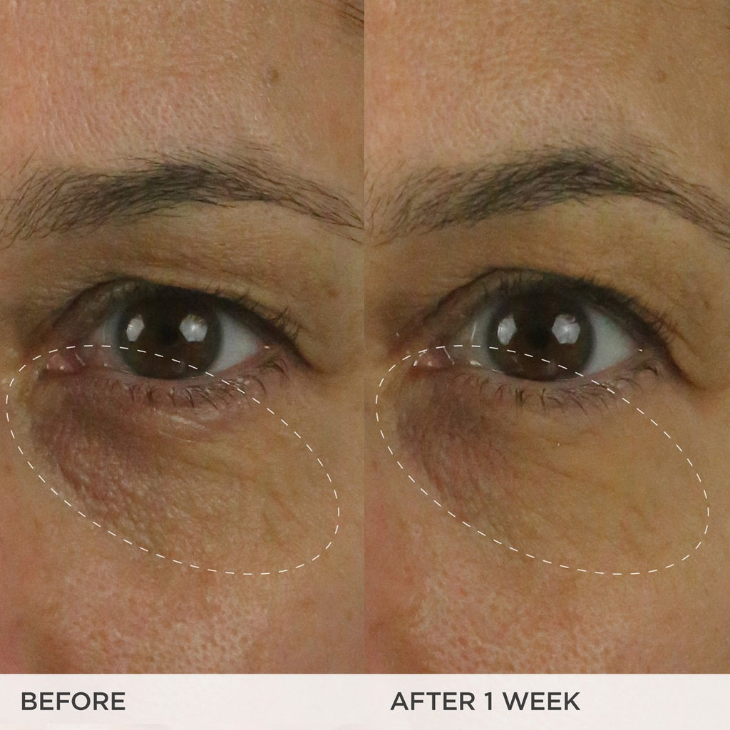 The Brightening Eye Cream - Everyday Beauty Essential