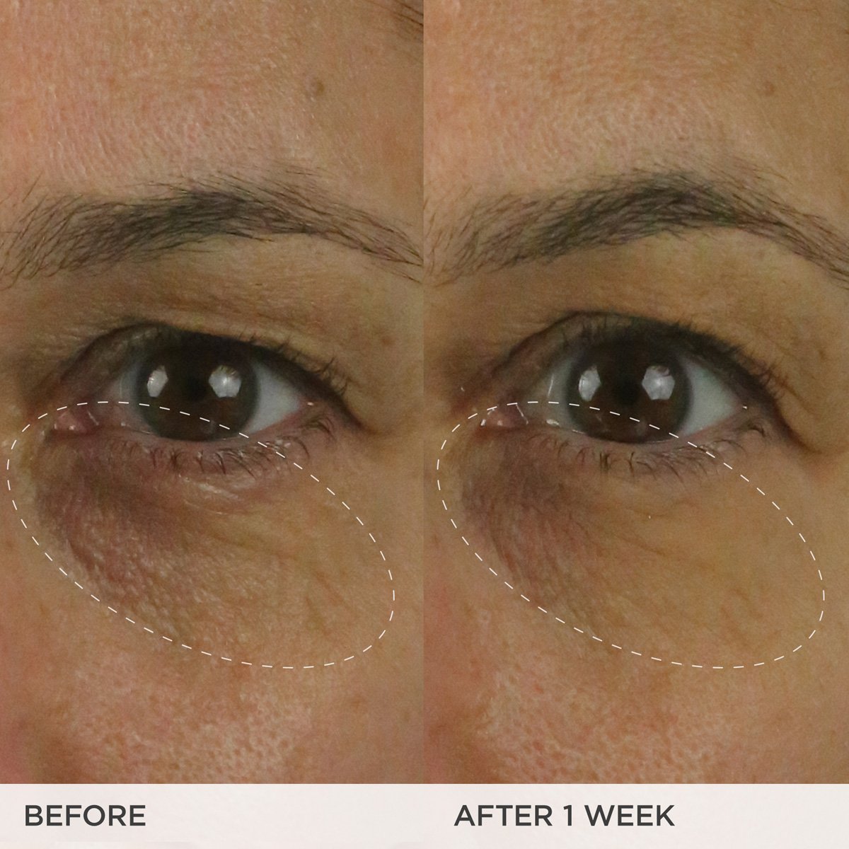 The Brightening Eye Cream - Everyday Beauty Essential