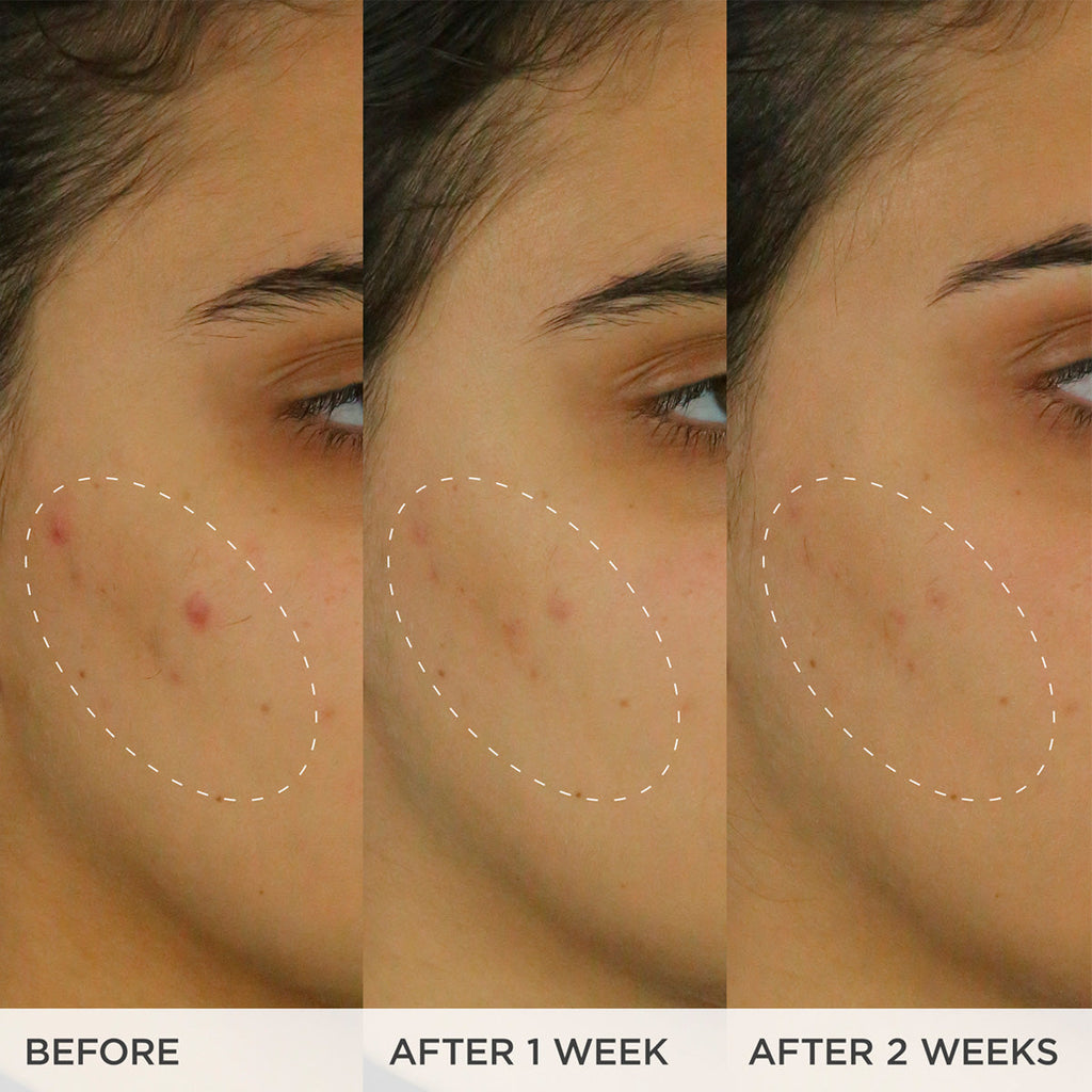 The Brightening Serum - Everyday Beauty Essential