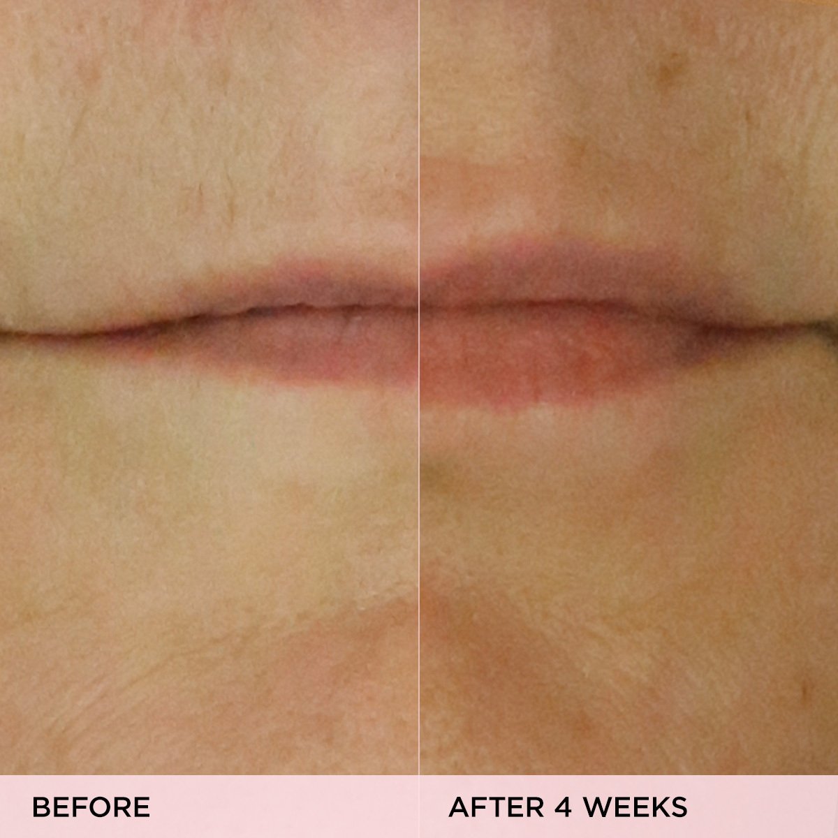 The Kissu Lip Treatment - Everyday Beauty Essential